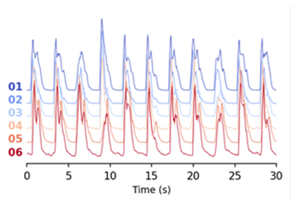 2D cardiac organoid electrical signal transmission 2