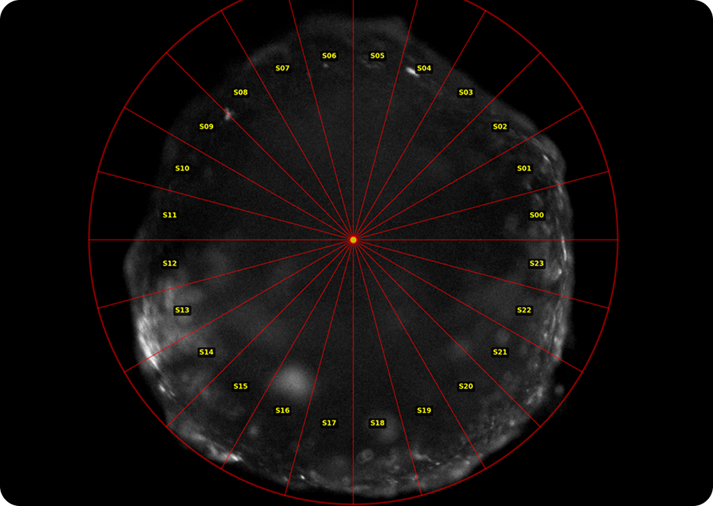 Evaluation of pulsation consistency by region in a single organoid
							using calcium variation fluorescence imaging 1